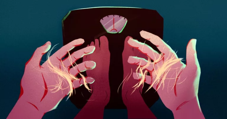 Are weight loss drugs causing hair loss? Doctors weigh in