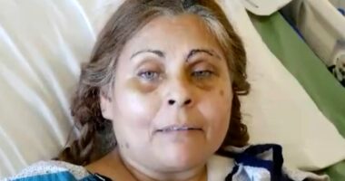 Factory worker who thought she would burn to death says falling into vat of chocolate saved her life