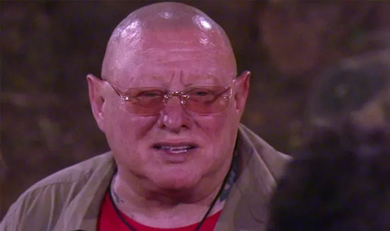 I’m A Celebrity star Shaun Ryder left with no eyelashes due to alopecia