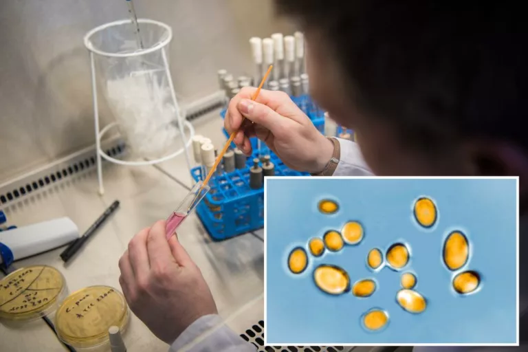 New York had record-high cases ‘diabolical’ fungal infection last year