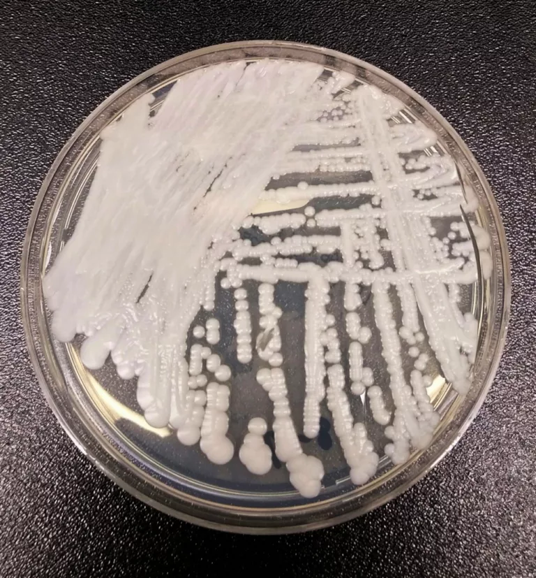 What makes Candida auris so dangerous?