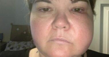 Woman awarded thousands after turning to 'unpleasant' DIY dentistry