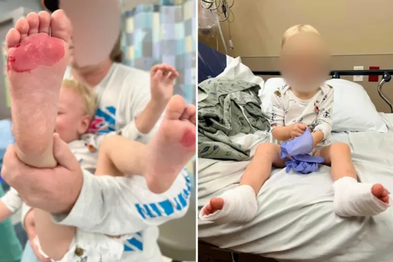 Arizona family sends warning after toddler suffers second-degree burns on feet from hot concrete