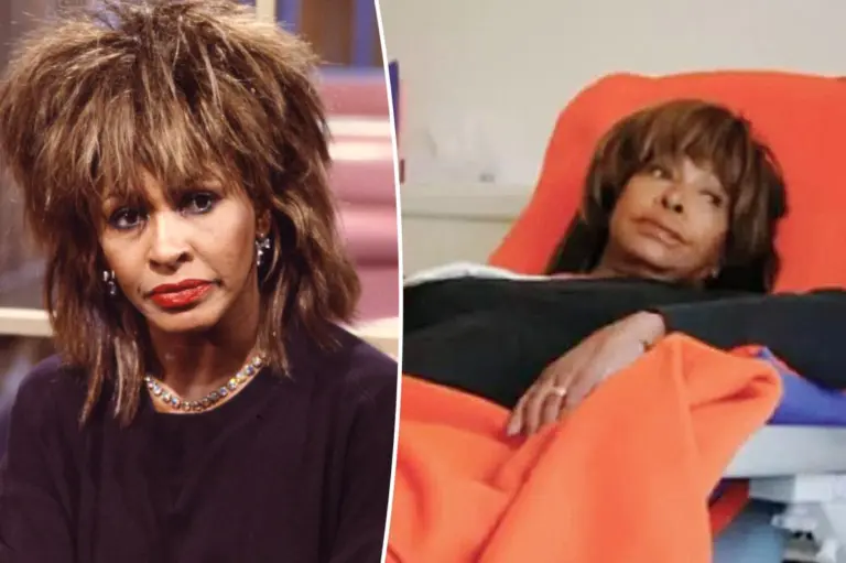 Tina Turner detailed kidney issues 2 months before death