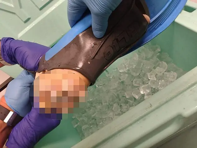 Yale graduate and runner, 22, has FOOT bitten off by shark while snorkeling on Turks and Caicos