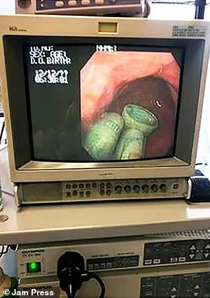 The above shows the rolls of cash inside the 67-year-old's stomach