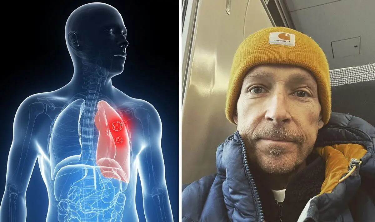 Five lung cancer causes to be aware of after Jonnie Irwin diagnosis