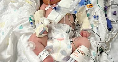 At 10 days old Luca was admitted to the ICU after he stopped breathing in his pram while mum Brooke Lahtinen was pleading with ED doctors to be seen