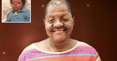 My mom abandoned me because of Apert syndrome — my son has it too