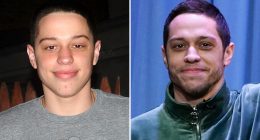 Pete Davidson -- Good Genes Or Good Docs?!