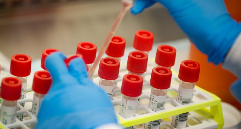 US should 'keep pressing' for COVID answers