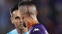 Fiorentina captain Cristiano Biraghi was treated for blood dripping down his neck after he was apparently hit by a vape pen while taking a corner in front of West Ham supporters