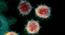 An electron microscope image of the virus that causes Covid-19.
