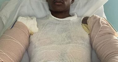 Jonte Gilmore, 26, spoke to DailyMail.com from his hospital bed in a Baltimore burns unit after he and his girlfriend were bound and tortured in a gruesome arson attack by murder suspect Jason Billingsley