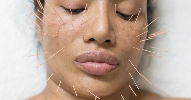 I Treated Myself to the Ultimate Luxury Session With London’s Leading Cosmetic Acupuncturist