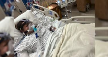It’s unclear what caused California woman to lose limbs, health officials say