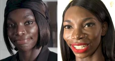 Michaela Coel: Unveiling The Details Of Her Plastic Surgery