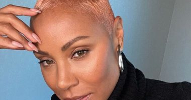 Jada Pinkett Smith, pictured, suffers from Alopecia areata, a common hair loss condition which affects 100,000 Britons