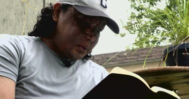 Nicaraguan man recounts long journey to get medical treatment at Cleveland Clinic: A Turning Point
