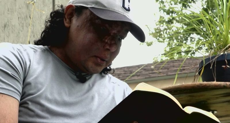 Nicaraguan man recounts long journey to get medical treatment at Cleveland Clinic: A Turning Point