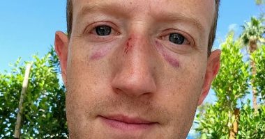 META CEO Mark Zuckerberg posted a photo on Instagram that showed two black eyes