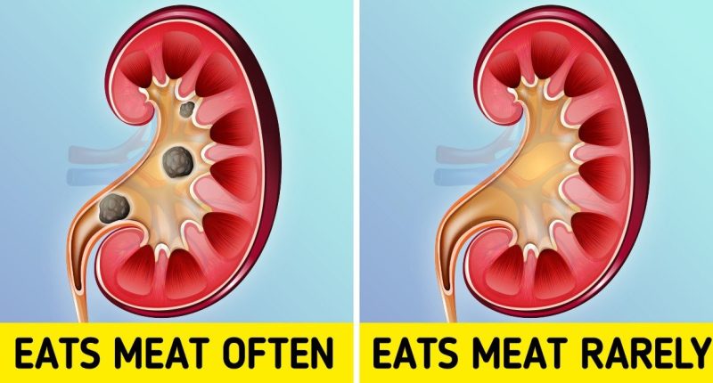 What Happens to Your Body When You Eat Too Much Meat