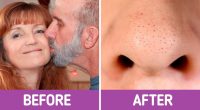 7 Everyday Things That You Probably Had No Idea Could Clog Your Pores