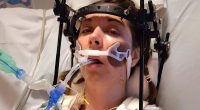 Doctors re-attach 'decapitated' Illinois woman's HEAD after she suffered horrific fall while exercising