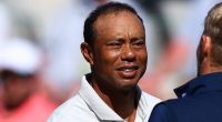 Tiger Woods Is A Reminder That Even Legends Can't Escape Receding Hairlines