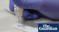 Trump administration axes key STI lab amid dramatic rise in US syphilis cases
