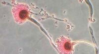 A fungi that can 'eat you from the inside out' could spread as the world heats up