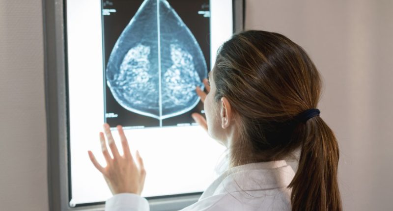 AI could streamline, improve mammography screenings: U of I professor