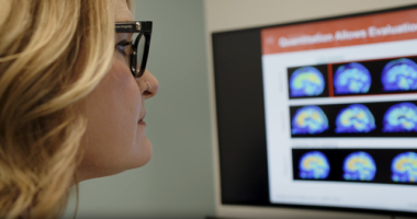 A first-of-its-kind treatment to slow the symptoms of early Alzheimer's disease has been approved for use in Australia.