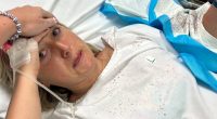 Woman in hospital gown with blood stains, holding her head.