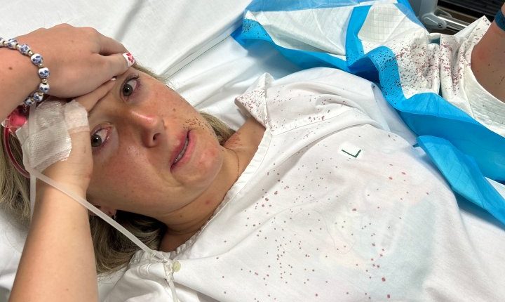 Woman in hospital gown with blood stains, holding her head.
