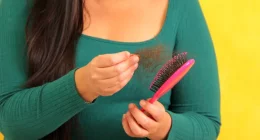 Why Diabetes Causes Hair Loss-Doctors