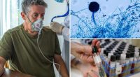 Dangerous fungus Aspergillus could spread to parts of US, researchers claim