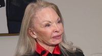 Distraught women show what plastic surgeon did to their faces