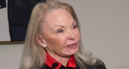 Distraught women show what plastic surgeon did to their faces