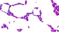 Drug-resistant fungus Candida auris reported in these 17 states