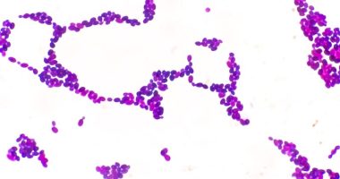 Drug-resistant fungus Candida auris reported in these 17 states
