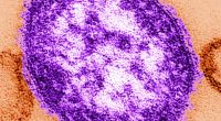 Fourth case of measles confirmed in Georgia