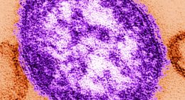Fourth case of measles confirmed in Georgia