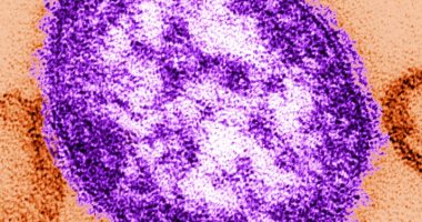 Fourth case of measles confirmed in Georgia