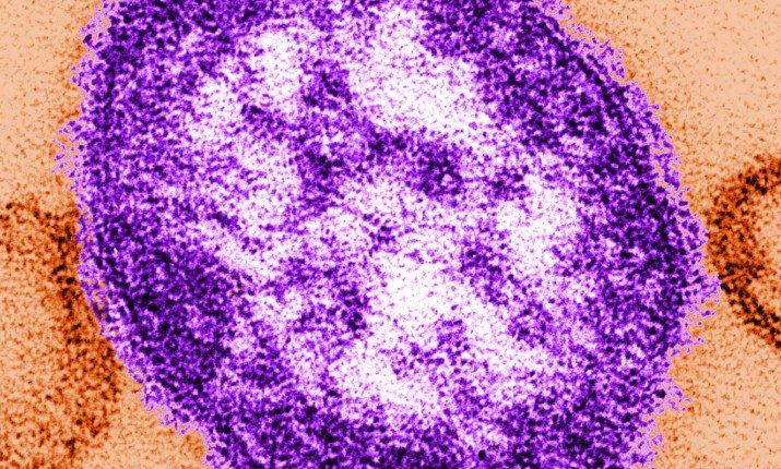 Fourth case of measles confirmed in Georgia