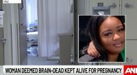 'Heartbeat law' not keeping pregnant woman alive, AG insists