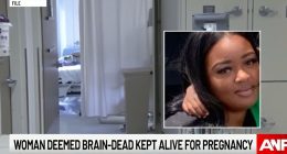 'Heartbeat law' not keeping pregnant woman alive, AG insists