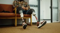 Illinois prosthetics service seeks to help those with limb loss throughout lives
