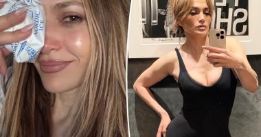 Jennifer Lopez cuts her face rehearsing for 2025 AMAs