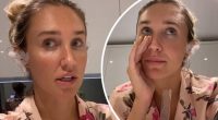 Megan McKenna reveals she has infected earlobes